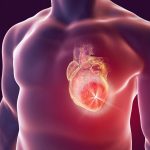 Nattokinase: Was ist das eigentlich?